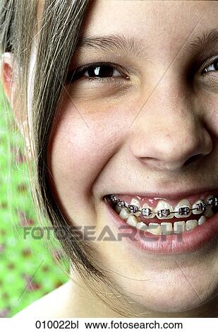 close-up portrait of young teenage girl smiling with braces View Large Photo Image Stock Image - close-up portrait of young teenage girl smiling with braces. Fotosearch