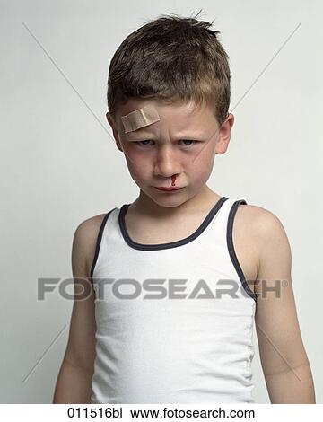 desperate looking boy with plaster on his forehead, bleeding from the nose View Large Photo Image Stock Image - desperate looking boy with plaster on his forehead, bleeding from the nose. Fotosearch