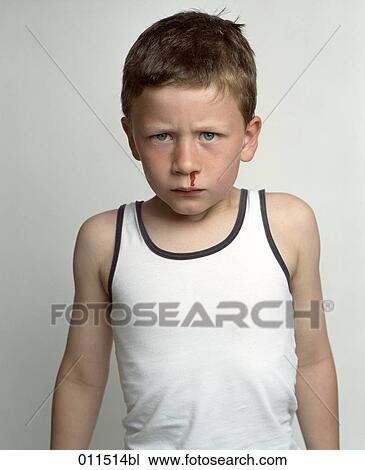 little boy in undershirt bleeding from the nose View Large Photo Image Stock Image - little boy in undershirt bleeding from the nose. Fotosearch