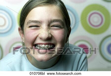 portrait of grinning girl showing her braces View Large Photo Image Stock Image - portrait of grinning girl showing her braces. Fotosearch