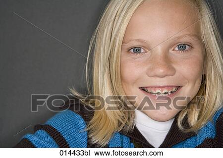 long haired teenage boy smiling showing braces on his teeth View Large Photo Image Stock Image - long haired teenage boy smiling showing braces on his teeth. Fotosearch