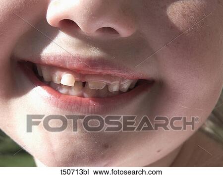 Girl with gap between her teeth View Large Photo Image Stock Image - Girl with gap between her teeth. Fotosearch