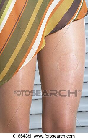 close-up of woman´s legs showing hole in stocking View Large Photo Image Stock Image - close-up of woman´s legs showing hole in stocking . Fotosearch