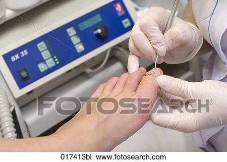 woman undergoing medical treatment of her feet View Large Photo Image Stock Image - woman undergoing medical treatment of her feet. Fotosearch