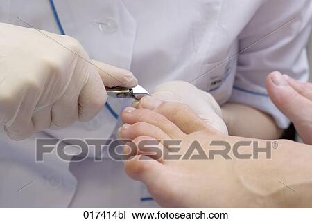 woman undergoing medical treatment of her feet View Large Photo Image Stock Image - woman undergoing medical treatment of her feet. Fotosearch