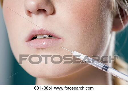 close-up of young woman getting injection in mouth View Large Photo Image Stock Image - close-up of young woman getting injection in mouth. Fotosearch