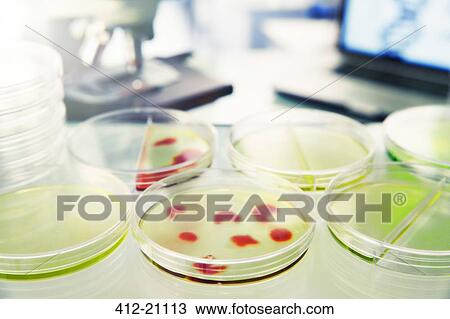 Close up of cultures in petri dishes in lab View Large Photo Image Stock Image - Close up of cultures in petri dishes in lab. Fotosearch