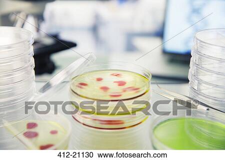 Close up of cultures in petri dishes on counter in lab View Large Photo Image Stock Image - Close up of cultures in petri dishes on counter in lab. Fotosearch