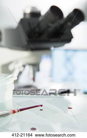Close up of pipette dropping sample onto microscope slide in lab View Large Photo Image Picture - Close up of pipette dropping sample onto microscope slide in lab. Fotosearch