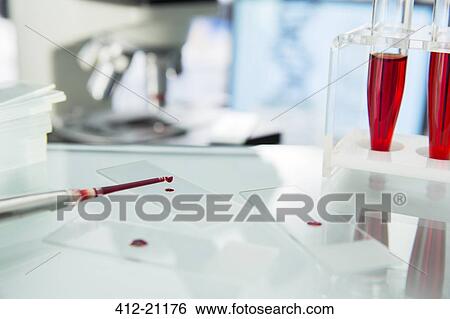 Close up of pipette dropping sample onto microscope slide in lab View Large Photo Image Stock Photograph - Close up of pipette dropping sample onto microscope slide in lab. Fotosearch