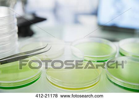 Cultures in petri dishes on counter in lab View Large Photo Image Stock Photo - Cultures in petri dishes on counter in lab. Fotosearch