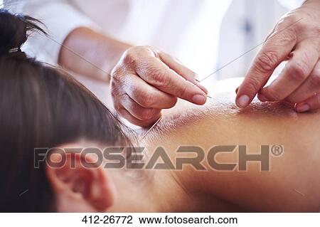 Close up acupuncturist applying acupuncture needles to woman’s neck View Large Photo Image Stock Image - Close up acupuncturist applying acupuncture needles to woman’s neck. Fotosearch