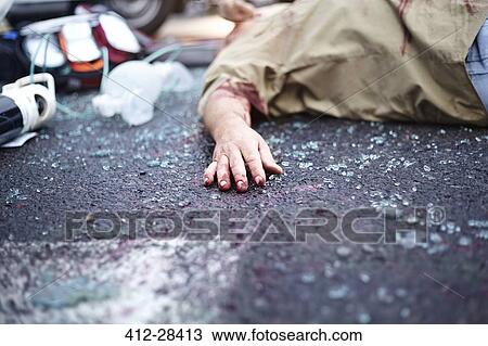 Stock Image - Bloody hand of car accident victim in road among shattered glass. Fotosearch