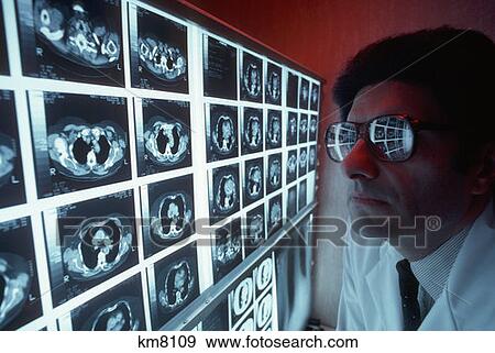 Stock Photo - Cat Scan Films Of Chest . Fotosearch