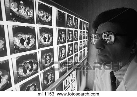 Stock Image - Close-Up Doctor Man Looking Over Catscan Films Of Chest Which Are Reflected In His Glasses . Fotosearch