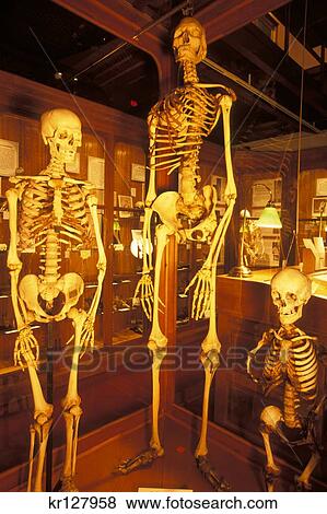 Philadelphia Pa Normal Giant And Dwarf Human Skeletons On Display At The Mutter Museum View Large Photo Image Stock Photo - Philadelphia Pa Normal Giant And Dwarf Human Skeletons On Display At The Mutter Museum . Fotosearch