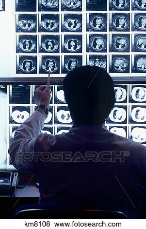Stock Photo - 1980S Silhouette Of Man Doctor Reading Cat Scan Films Of Chest . Fotosearch