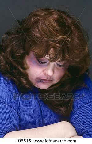 1990S Battered Woman With Bruised Face Black Eye Abused Injured Beaten View Large Photo Image Stock Photography - 1990S Battered Woman With Bruised Face Black Eye Abused Injured Beaten . Fotosearch