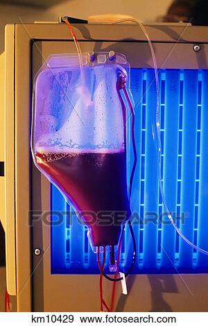 Stock Photo - 1990S Blood Of Patient With Mycosis Fungoides Cancer Is Treated By Uv Light And Drugs . Fotosearch