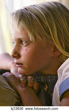 Stock Image - Young Teenage Girl With Battered Face . Fotosearch