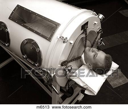 1930s 1940s 1950s MAN LYING IN IRON LUNG NEGATIVE PRESSURE VENTILATOR ARTIFICIAL BREATHING MACHINE View Large Photo Image Stock Image - 1930s 1940s 1950s MAN LYING IN IRON LUNG NEGATIVE PRESSURE VENTILATOR ARTIFICIAL BREATHING MACHINE. Fotosearch