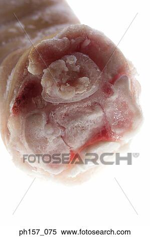 Frozen chicken, close-up View Large Photo Image Stock Photography - Frozen chicken, close-up. Fotosearch