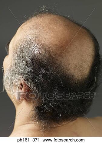 Stock Image - Close-up of mature man's head, top view. Fotosearch