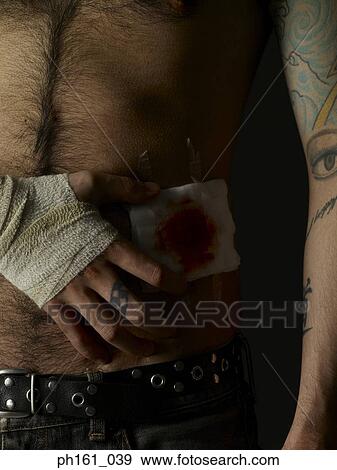 Stock Photo - Man with bandages on his hand and torso. Fotosearch