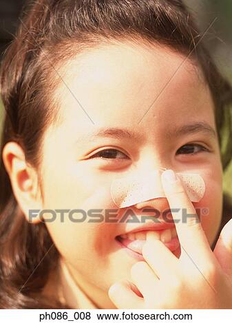 Young girl with plaster on nose View Large Photo Image Stock Photo - Young girl with plaster on nose. Fotosearch