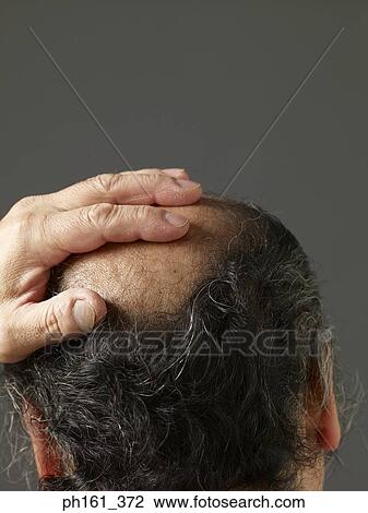 Stock Image - Close-up of mature man touching his balding head, rear view. Fotosearch