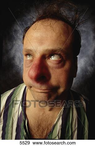 Stock Photo - Man with a cold. Fotosearch