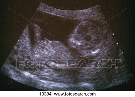 Picture - Ultrasound image of fetus in womb. Fotosearch