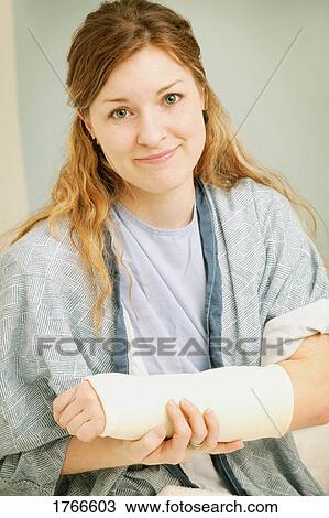 Stock Image - A broken wrist. Fotosearch