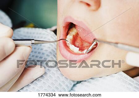 Picture - Treatment at the dentist. Fotosearch