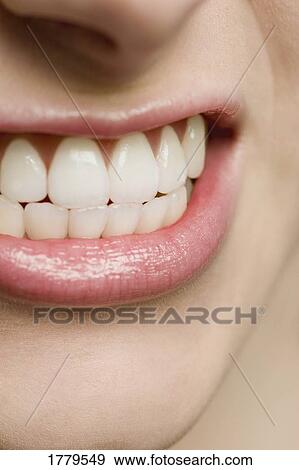 Teeth clenched View Large Photo Image Stock Photo - Teeth clenched. Fotosearch