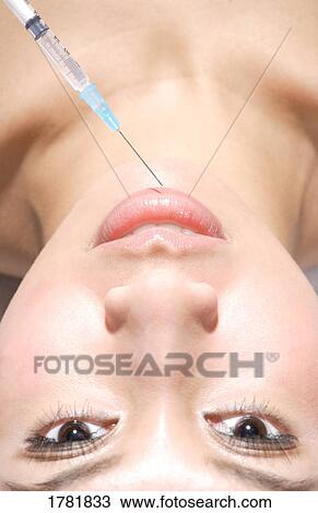 Stock Image - Woman receiving collagen injection. Fotosearch
