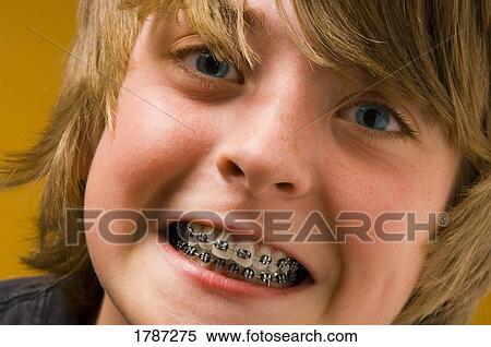 Boy with braces View Large Photo Image Stock Photography - Boy with braces. Fotosearch