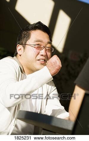Stock Image - Man with disfigured hand. Fotosearch