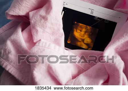 Picture - Three dimensional ultrasound photo. Fotosearch