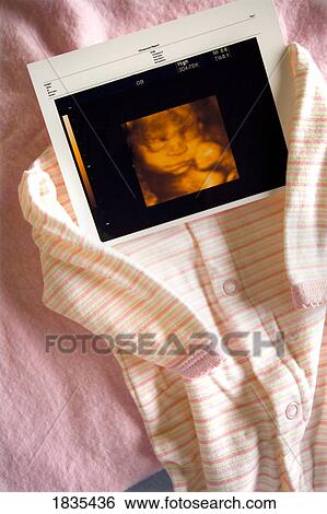 Stock Photograph - Three dimensional ultrasound photo. Fotosearch