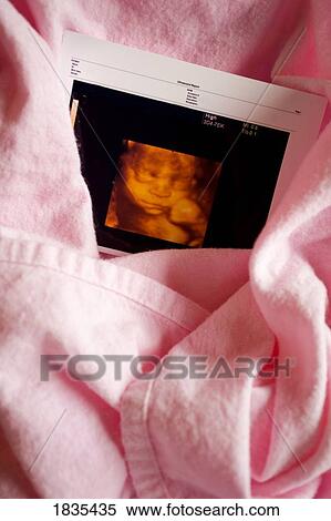 Three dimensional ultrasound photo View Large Photo Image Stock Photography - Three dimensional ultrasound photo. Fotosearch
