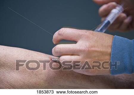 Doctor giving patient a needle View Large Photo Image Stock Image - Doctor giving patient a needle. Fotosearch