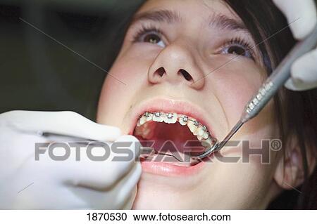 a teenager with braces having their mouth examined by the dentist View Large Photo Image Stock Image - a teenager with braces having their mouth examined by the dentist. Fotosearch