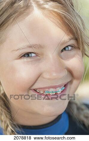 Portrait of a girl with braces; lake tahoe california united states of america View Large Photo Image Stock Photo - Portrait of a girl with braces; lake tahoe california united states of america. Fotosearch