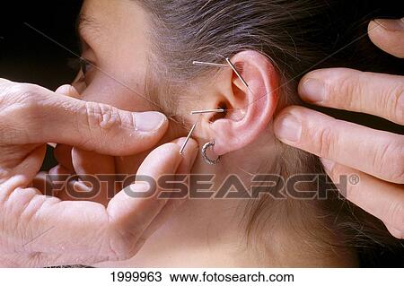 Acupuncture To Woman's Ear, Close-Up View Large Photo Image Stock Image - Acupuncture To Woman's Ear, Close-Up. Fotosearch