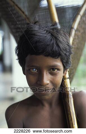 Stock Photograph - Bangladesh, Boy With Cataract; Khulna. Fotosearch