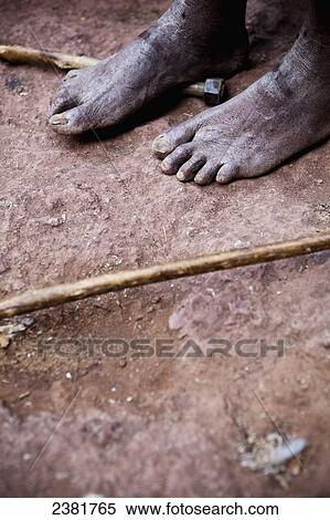Bare feet of a pilgrim at the Orthodox Easter celebrations; Lalibela, Ethiopia View Large Photo Image Stock Photography - Bare feet of a pilgrim at the Orthodox Easter celebrations; Lalibela, Ethiopia. Fotosearch