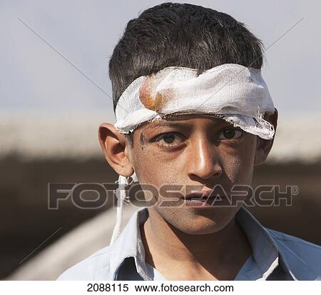 Stock Photography - Boy Injured By The 8 October 2005 Earthquake, Chikar, Azad Kashmir, Pakistan. Fotosearch