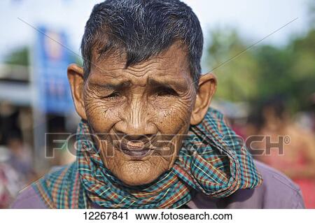 Stock Image - Elderly man with one eye; Battambang, Cambodia. Fotosearch