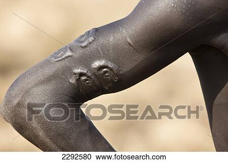 Stock Image - Ethiopia, Southern Nations Nationalities And Peoples' Region, South Omo, Close Up Of Traditional Scar Decorations Amongst Mursi Tribal Men; Makki. Fotosearch